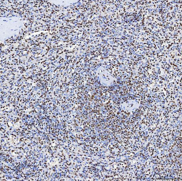  IHC analysis of SF3B3 using anti-SF3B3 antibody (A08240-3)