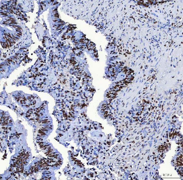 a08240 3 sf3b3 primary antibodies ihc testing 4