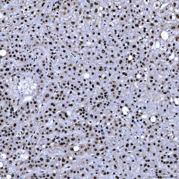 a08240 3 sf3b3 primary antibodies ihc testing 6