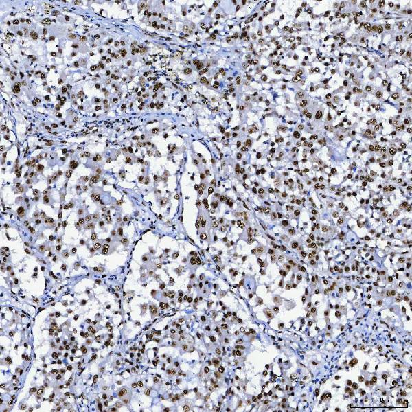 a08240 3 sf3b3 primary antibodies ihc testing 7