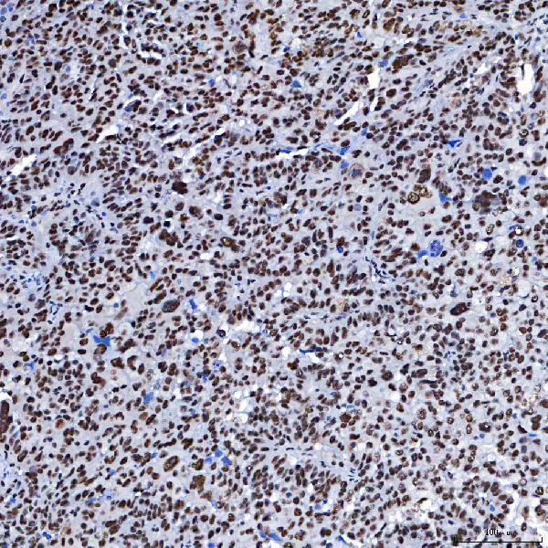 a08240 3 sf3b3 primary antibodies ihc testing 8