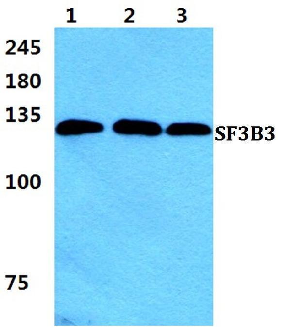 Western blot (WB) analysis of SF3B3 polyclonal antibody at 1:500 dilution
Lane1:HEK293T cell lysate
Lane2:sp2/0 cell lysate
Lane3:H9C2 cell lysate