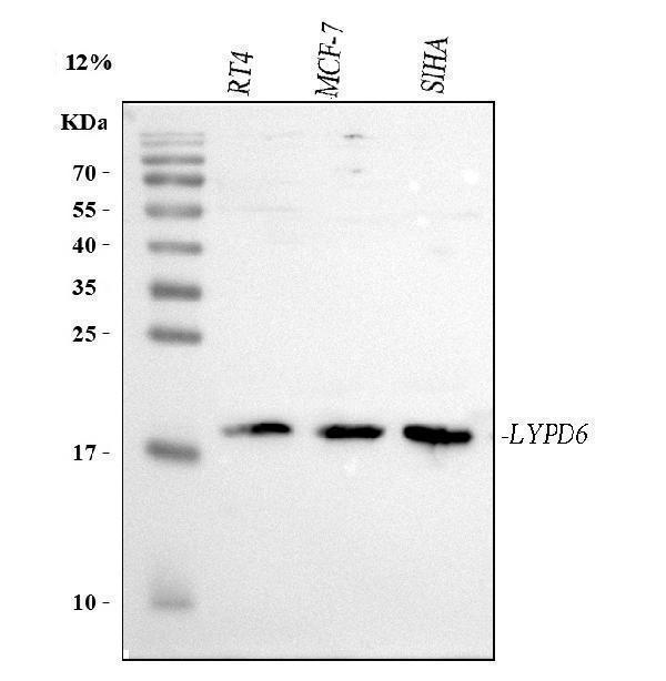  Western blot analysis of LYPD6 using anti-LYPD6 antibody (A16132-1)