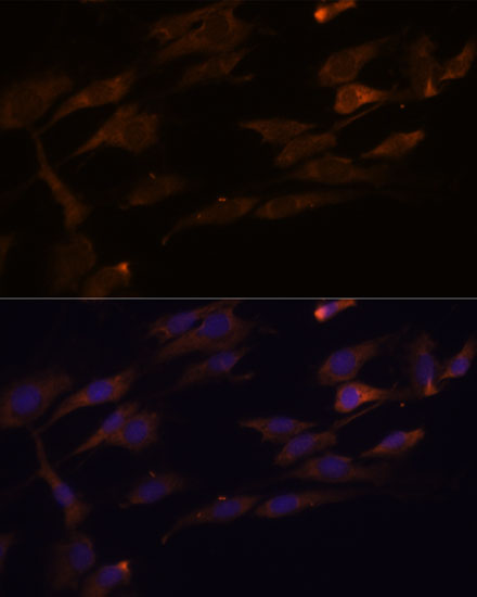 a08246 rpl7a primary antiboties if testing 2