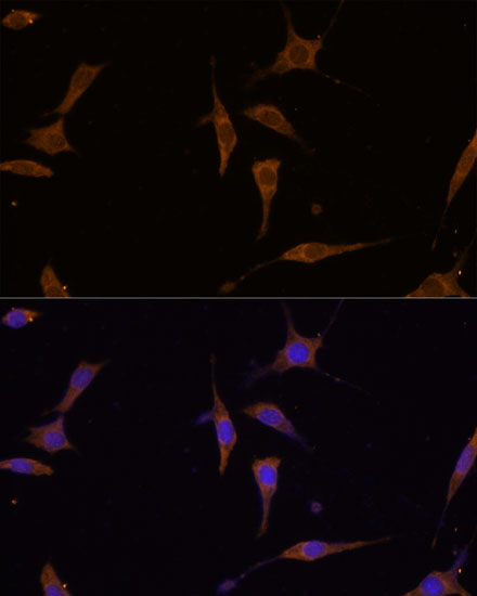 a08246 rpl7a primary antiboties if testing 3