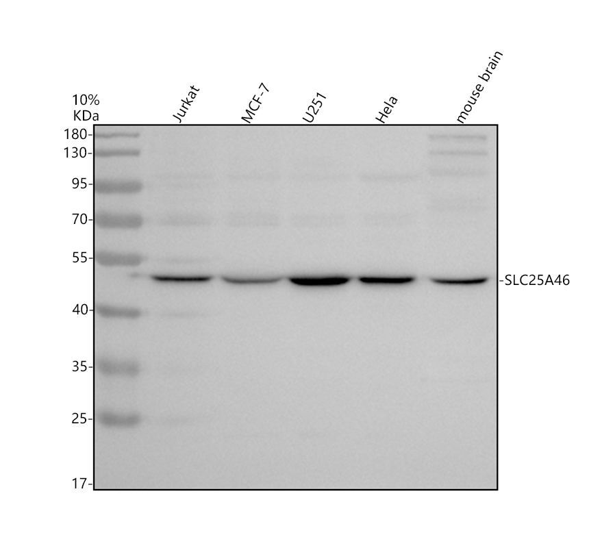 Western blot analysis of SLC25A46 using anti-SLC25A46 antibody (A08250-1)