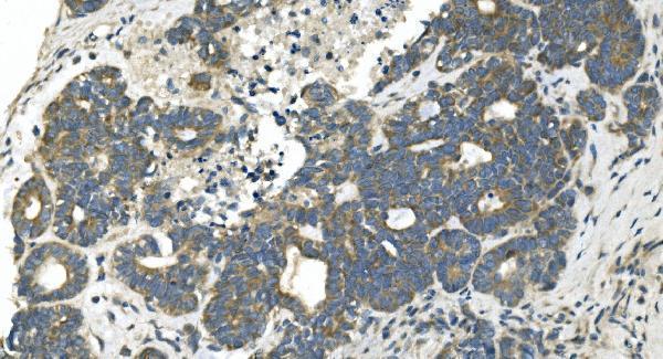 a08251 2 cdc123 primary antibodies ihc testing 2