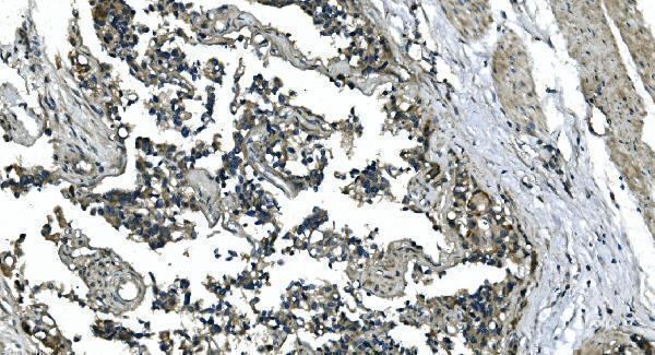 a08251 2 cdc123 primary antibodies ihc testing 5