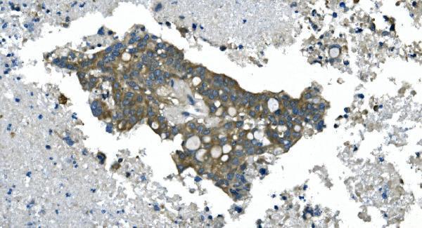 a08251 2 cdc123 primary antibodies ihc testing 9