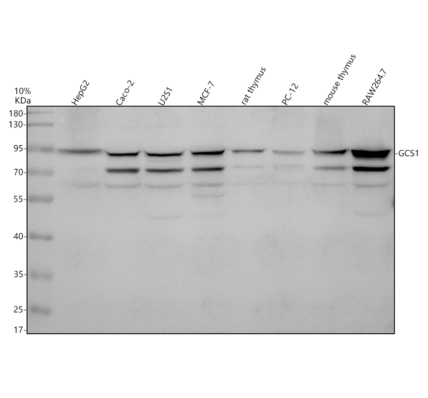 Western blot analysis of GCS1 using anti-GCS1 antibody (A08252-1)