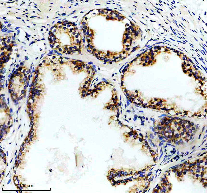 a08254 2 eci2 primary antibodies ihc testing 2