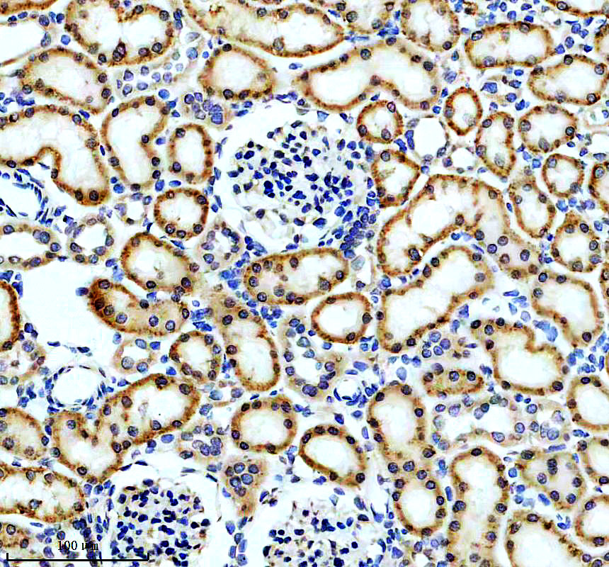 a08254 2 eci2 primary antibodies ihc testing 3