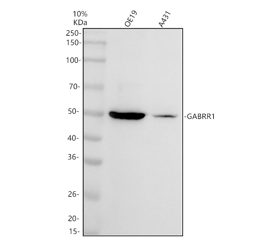 a08260 2 gabrr1 primary antibodies wb testing 1