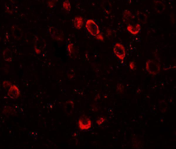 Immunofluorescence of SPRYD2 in mouse brain tissue with SPRYD2 antibody at 20 μg/mL