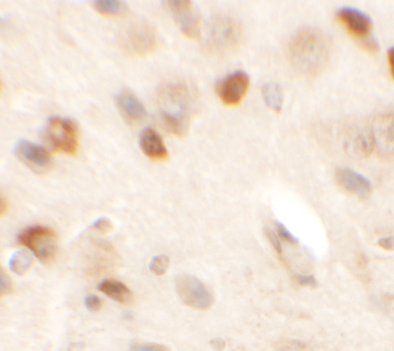 Immunohistochemistry of SPRYD2 in mouse brain tissue with SPRYD2 antibody at 2