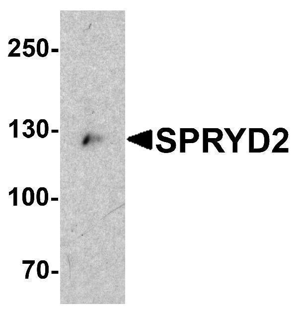 Western blot analysis of SPRYD2 in mouse heart tissue lysate with SPRYD2 antibody at 1 μg/mL