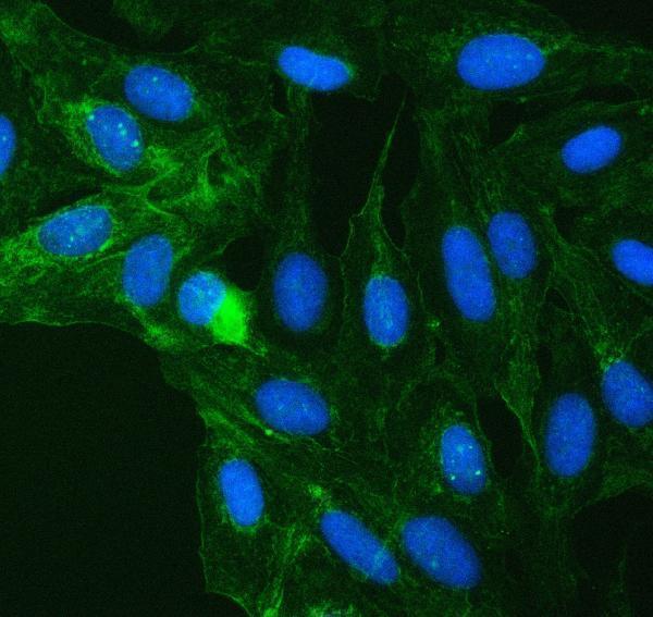 a08268 1 suclg2 primary antibodies if testing 12