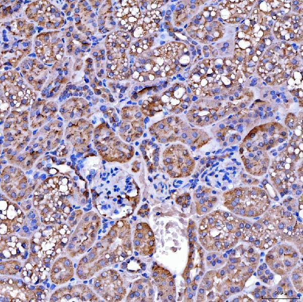 a08268 1 suclg2 primary antibodies ihc testing 10