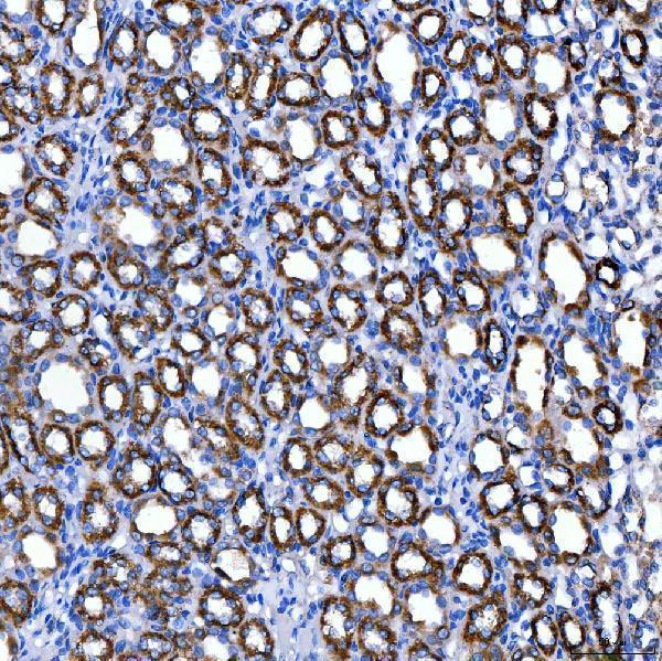 a08268 1 suclg2 primary antibodies ihc testing 11