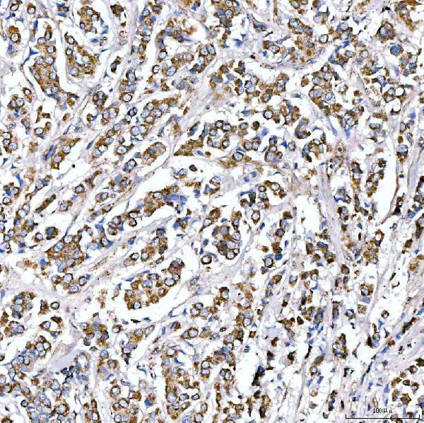  IHC analysis of SUCLG2 using anti-SUCLG2 antibody (A08268-1)