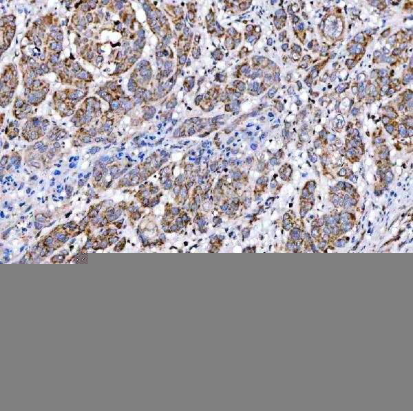 a08268 1 suclg2 primary antibodies ihc testing 5