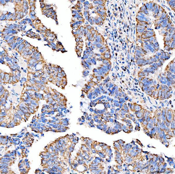 a08268 1 suclg2 primary antibodies ihc testing 6
