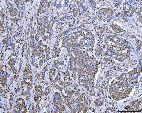 a08268 1 suclg2 primary antibodies ihc testing 8