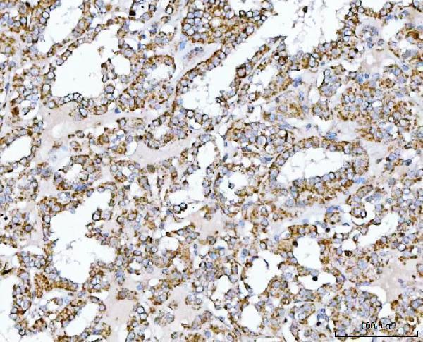 a08268 1 suclg2 primary antibodies ihc testing 9