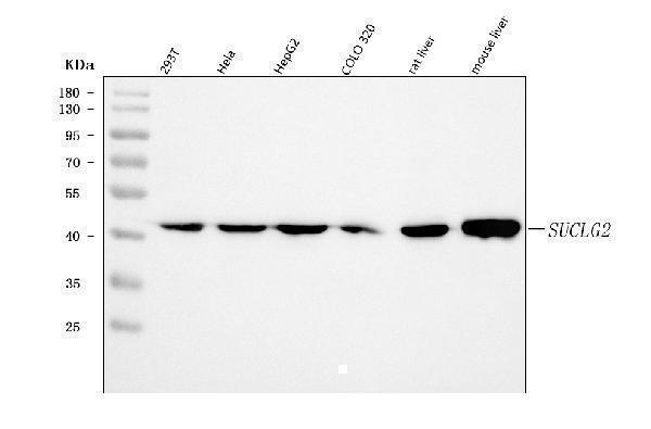  Western blot analysis of SUCLG2 using anti-SUCLG2 antibody (A08268-1)
