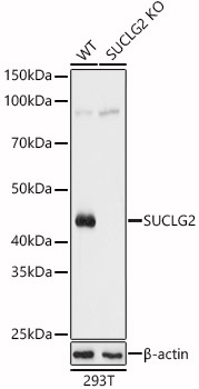 Western blot analysis of extracts from wild type and SUCLG2 knockout  293T cells, using SUCLG2 antibody  at 1:3000 dilution