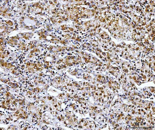  IHC analysis of NDUFS8 using anti-NDUFS8 antibody (A08275-2)