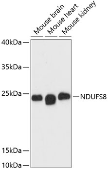 Western blot analysis of extracts of various cell lines, using NDUFS8 antibody  at 1:3000 dilution