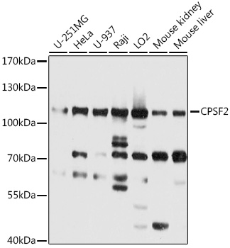 Western blot analysis of extracts of various cell lines, using CPSF2 antibody  at 1:2000 dilution