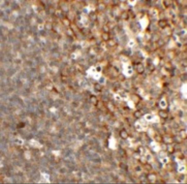 a08278 tfcp2l1 primary antibodies ihc testing 2