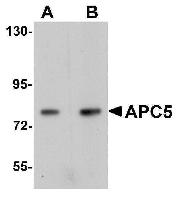 a08280 1 anapc5 primary antibodies wb testing 1