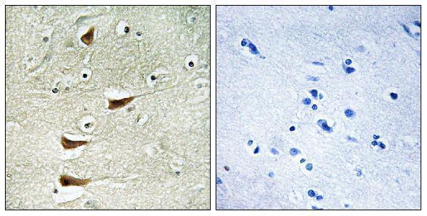 a08285 1 map3k10 primary antibodies ihc testing 1