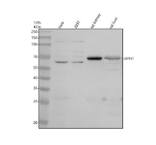 Western blot analysis of DPH1 using anti-DPH1 antibody (A08287-1)