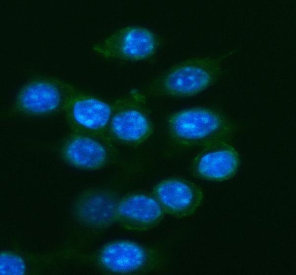 a08288 1 slc26a8 primary antibodies if testing 1