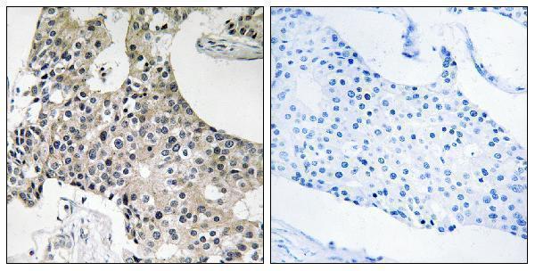 a08289 tecr primary antibodies ihc testing 1