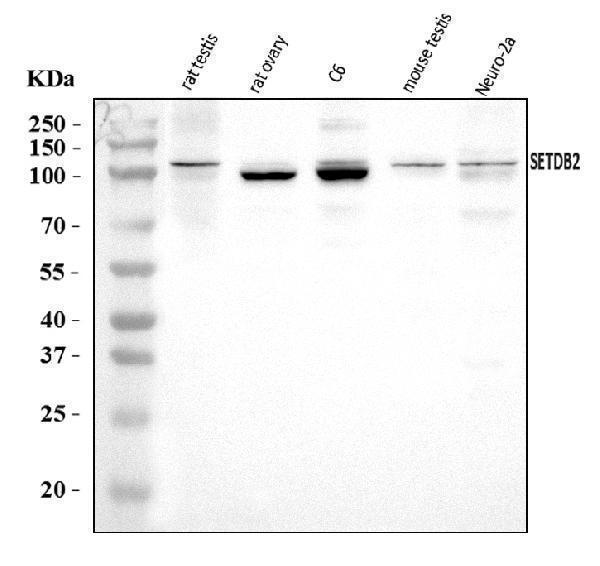  Western blot analysis of CLLD8/Setdb2 using anti-CLLD8/Setdb2 antibody (A08290-3)