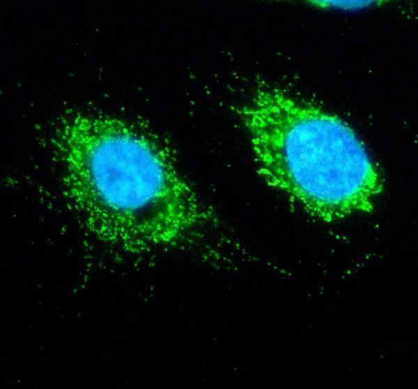 a08297 1 slirp primary antibodies if testing 3