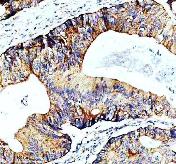IHC analysis of SLIRP using anti-SLIRP antibody (A08297-1)