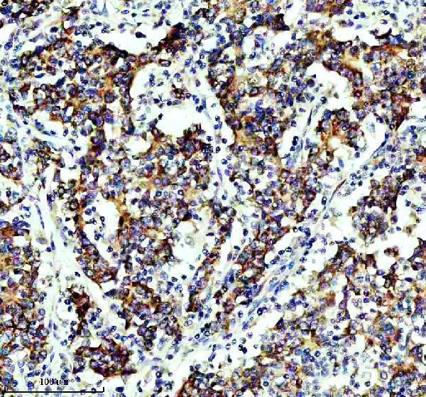 IHC analysis of SLIRP using anti-SLIRP antibody (A08297-1)