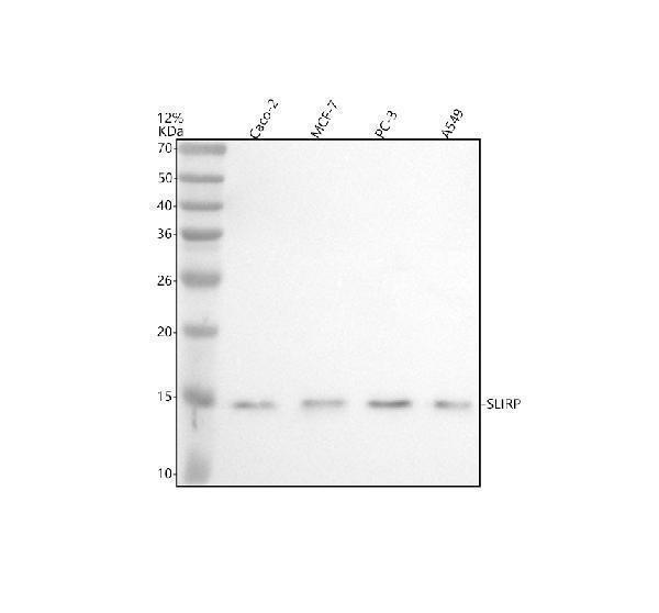 Western blot analysis of SLIRP using anti-SLIRP antibody (A08297-1)
