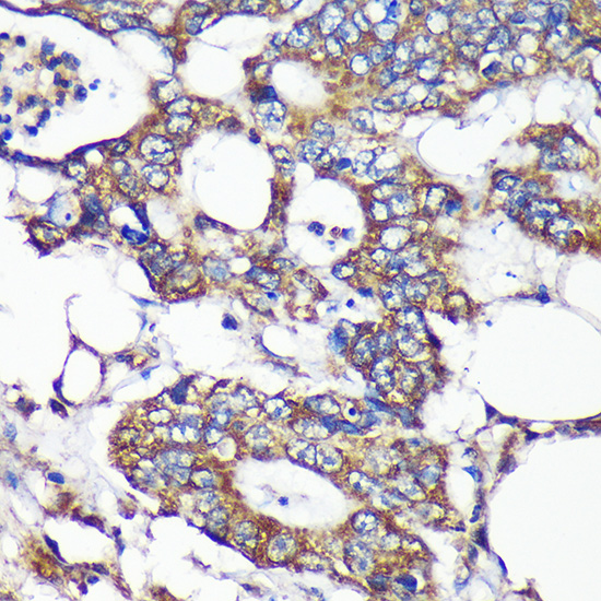 a08297 slirp primary antiboties ihc testing 2
