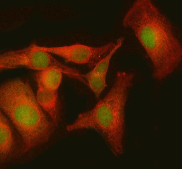  IF analysis of MBNL3 using anti-MBNL3 antibody (A08298) and anti-Beta Tubulin antibody (M01857-3)