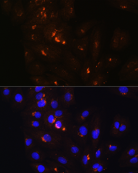 a08299 pofut2 primary antiboties if testing 2