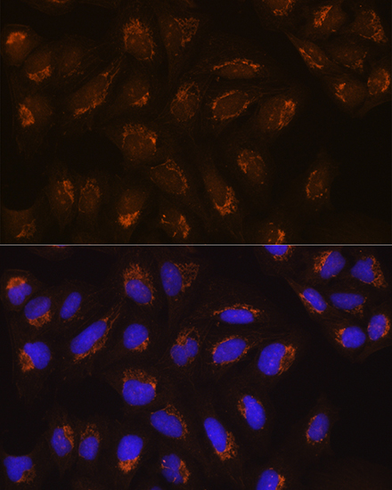 a08299 pofut2 primary antiboties if testing 3