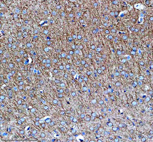 a08300 1 glce primary antibodies ihc testing 1