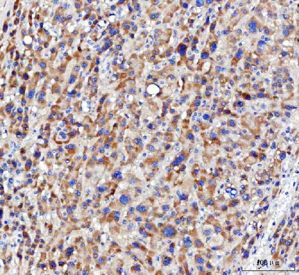  IHC analysis of NUDT6 using anti-NUDT6 antibody (A08301-1)